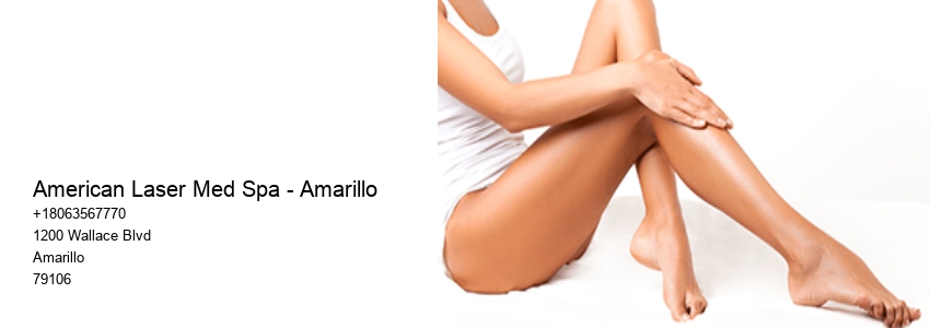 Free Consultations